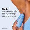 Peach Slices Smoothing Solution Ingrown Hair Treatment