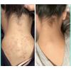 Tabella Skincare Goodbye Dark Spots Hello Brighter Skin, Fast & Effective, 5oz.