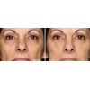 Youth-preserving lotion - ANTI-WRINKLE COMPLEX - Wrinkle-resisting blend 1Bot 60