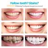2X Niacinamide Whiten Toothpaste Natural Niacinamide Toothpaste Teeth Whitening
