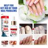 Fungal Nail Treatment for Toenails Extra Strong, Toenail Fungus Treatment Nail Repair for Fingernails Toenails, Toe Nail Fungal Treatment Fungal Nail Solution Fixes Nails Safe Effective (50ML)