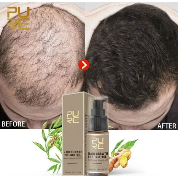 PURC Hair Growth Essence Oil Hair Loss Treatment Help for hair 20ML