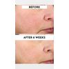 Lawless Forget the Filler Perfecting Cream