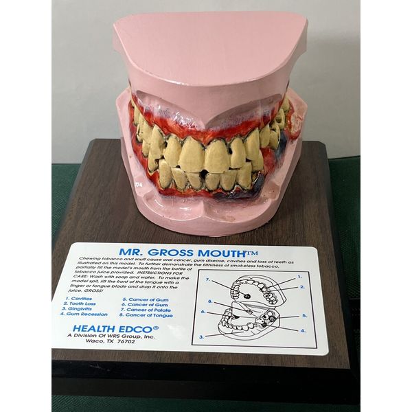 Health Edco Smokeless Tobacco Mouth Medical Model & Case Mr. Gross Mouth