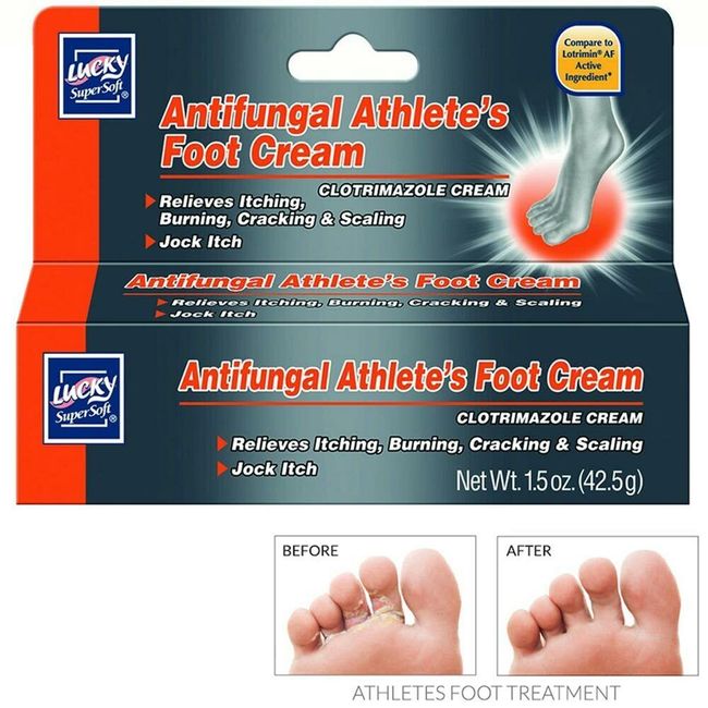 Antifungal Athlete's Foot Cream Treatment Jock Itch Ringworm Itching Anti Fungus