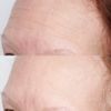 Perricone MD High Potency Hyaluronic Intensive Hydrating Mask - 59ml