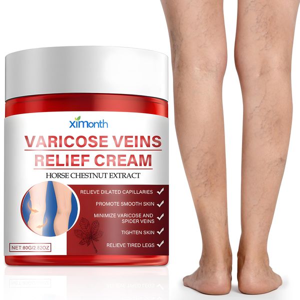 Varicose Veins Cream Beine Besenreiser Entfernen Varicose Veins Relief Cream Creme Gegen Besenreiser Krampfadern Care Creme for Legs Varicose Vein & Soothing Leg Cream, 80g