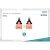 DIGITUS CAT 6 U-UTP Patch Cable, 3m, Network LAN DSL Ethernet Cable, LSZH, Copper, AWG 26/7, Black