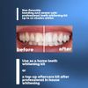 Home Teeth Whitening Kit