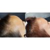 DAMO hair loss control scalp Tonic