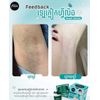Felix Armpit Solution Cream លេលាបក្លៀកសរ ( 18g )