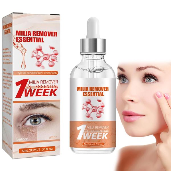 Speedy Milia Remover,Milia Remover,Milia Remover Under Eyes,Milia Spot Serum for Face,Helps Dissolve and Reduce Milia,Dark Spot Remover,to Reduce Milia, Dark Circles Under Eye for Women & Men