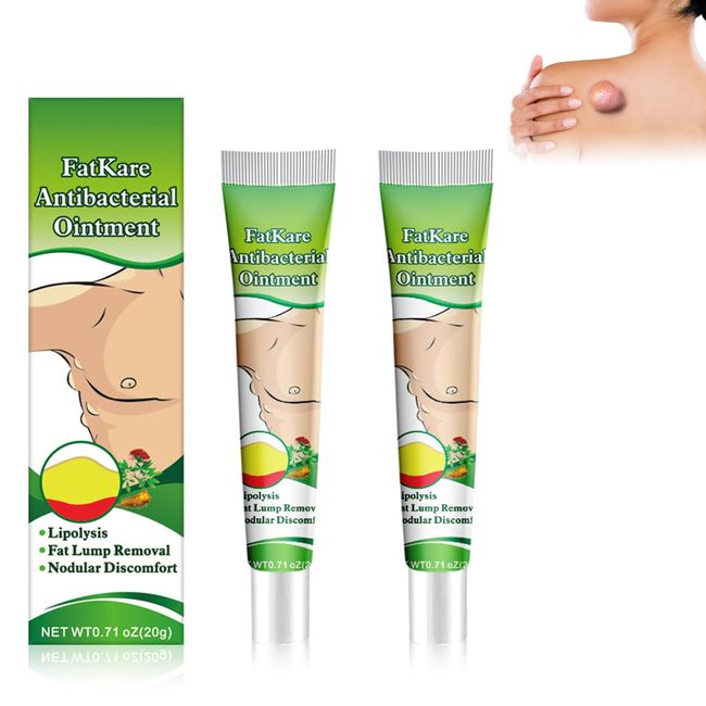 Lipoma Roll 2PC Lipoma Removal Cream,Lipom-Klumpen-Entfernungscreme,Herbal Lipom Lumps Removal Cream,Lymphatic Detox Cellulite Removal Cream,Lipom-Entfernung Creme,For Lump Dredging