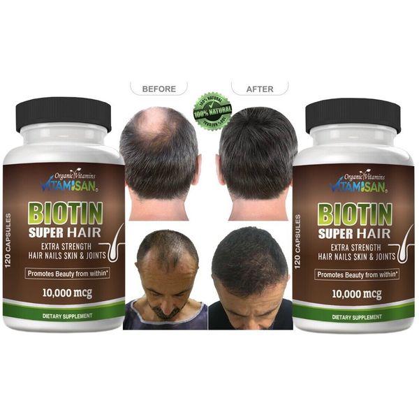 Hair Growth Vitamins Hair Loss support to Growth  240 caps GROW BOOST