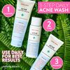 Peach Slices | Acne Clarifying Cleanser | Deep Cleans & Prevents Acne | 2% Salicylic Acid | Hyaluronic Acid | Sulfate-Free | Hydrates & Calms Skin | Gentle Formula | Face Wash | Cruelty-Free | 4 oz