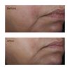 Perricone MD No: Rinse Intensive Pore Minimizing Toner