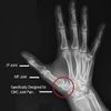 Comfort Cool Thumb CMC Restriction Splint, Right, Medium