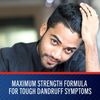Selsun Blue Medicated Maximum Strength Dandruff Shampoo, 11 Ounce