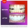 Colgate Optic White ComfortFit Teeth Whitening Kit with LED Light and Whitening Pen, LED Teeth Whitening Kit, Enamel Safe, Works with iPhone and Android