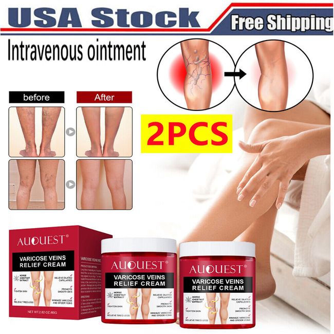 2PC Varicose Veins Relief Cream Vasculitis Phlebitis Spider Pain Relief Ointment