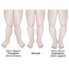 LAMINET Posture Corrective Heel Cups - Large - Fits Women's Shoe Size 8.5-11 / Fits Men's Shoe Size 7-13