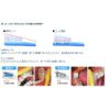 Thumb Friend One Step #80 1pc Yellow