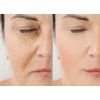 VITALITY PRECISION SKIN 15% Glycolic Cream