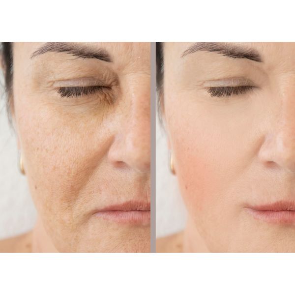 VITALITY PRECISION SKIN 15% Glycolic Cream
