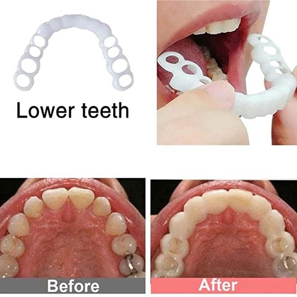 dentures dentures false male and female dentures teeth glue teeth repair kit, dentures that meet chipped, broken teeth and gaps, false teeth repair kit, easy to install smile with confidence natural