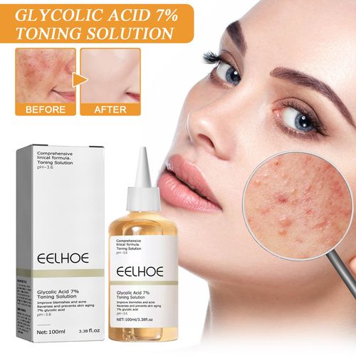 Acido Glicolico Glycolic Acid 7% Toning Resurfacing Solution Glycolic Acid Serum Face Skincare Peeling Solution Hydrating Toner Per Macchie E Acne 100 ML Con 1 Massaggiatore Per Il Viso