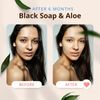 Combat Oily Skin with Black Soap's Natural Balance