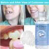 Tooth Repair Kit - Temporary Teeth Replacement Kit for Missing & Broken Teeth US