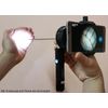 ClaraMed phone endoscope adapter with Olympus compatible LED light source S3