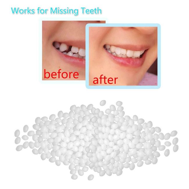Temporary Tooth Repair Kit Teeth Veneers Moldable Fake Teeth