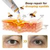 Furzero Bee Venom Wrinkle Removal Cream