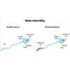 SPERM BOOSTER - Increase Sperm Count - Powerful Ejaculations - to Treat & Preven