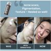 DERMA EZ JET Multi Effector Ampoule Microneedling Package