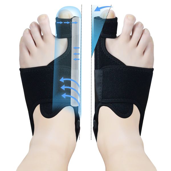 1 Pair Bunion Corrector for Women & Men, Night Bunion Splint, Big Toe Straightener, Bunion Brace for Bunion Pain Relief