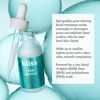 Bliss Clear Genius Clarifying Overnight Liquid Peel - 1 Fl Oz - Clear Pores & Exfoliate Skin - Non-Irritating - Clean - Vegan & Cruelty-Free