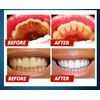 Intensive Stain Removal Teeth Whitening Toothpaste Fight Bleeding Gums Blueberry