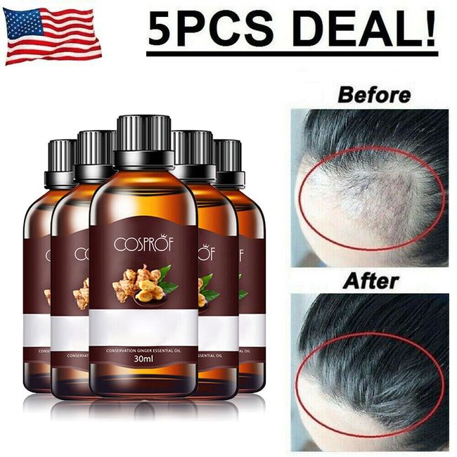 5Pcs Fast Hair Growth Dense Regrowth Ginger Serum Oil Loss Treatment Essence