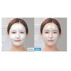 10 Pcs MediAnswer Pore Collagen Mask 37g