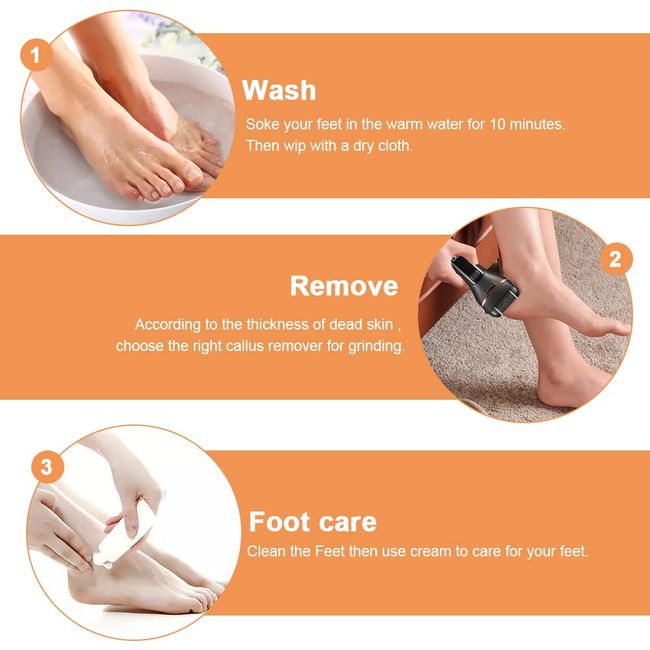 Electric Foot File - Callus & Hard Skin Remover for Spa & Foot Care -  Portable Pedicure Tools for Dry Dead & Cracked Feet