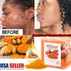 2 Pack Tumeric Soap Acne Dark Spots Removal Skin Whitening Body Bleaching Soap