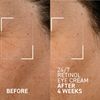 BTW 24/7 Retinol eye cream - RETAIL BOTTLE