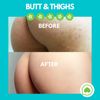 SKINBOSS Clearing Lotion for Body, Back, Bum, & Thigh