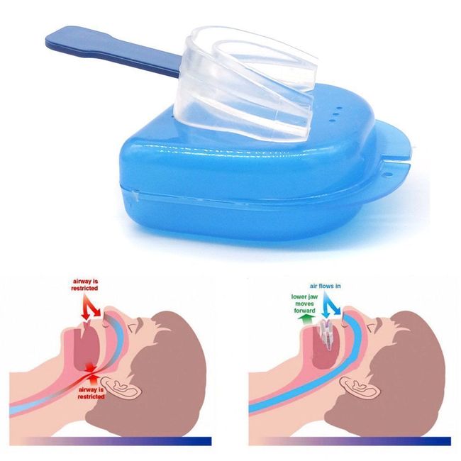 Anti Snore Mouthpiece Aid Stop Snoring Device Apnea Guard Bruxism Sleeping Aids