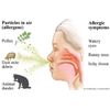 Allergy Sinus Relief Tincture-Homeo