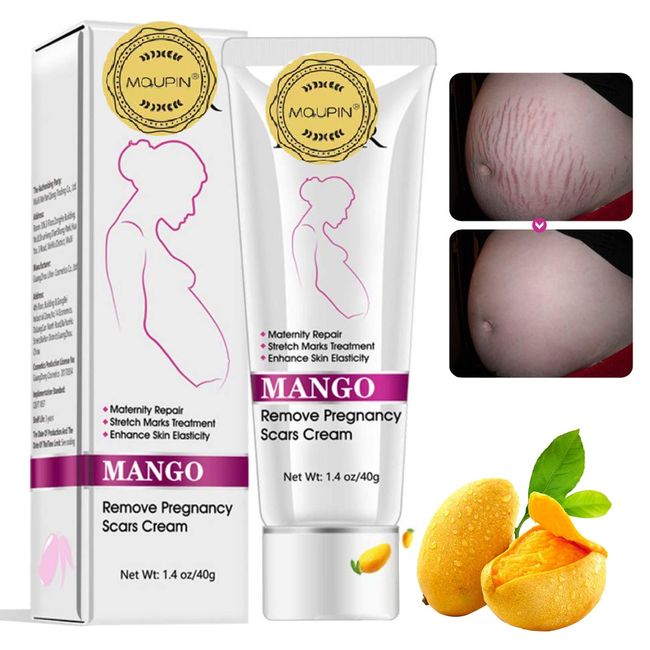 RtopR Mango Stretch Marks and Scar Cream -Stretch Marks and Scar Removal Cream for Pregnancy - Best Body Moisturizer-40g