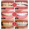 SP Brightening Toothpaste with Stain Removal, Fresh Breath & Probiotic Toothpaste